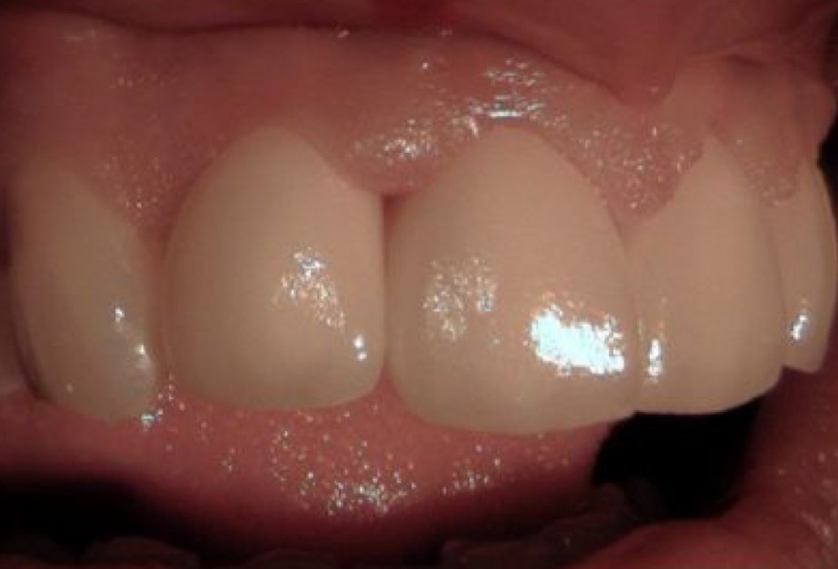saubere Zahnfleischverhältnisse